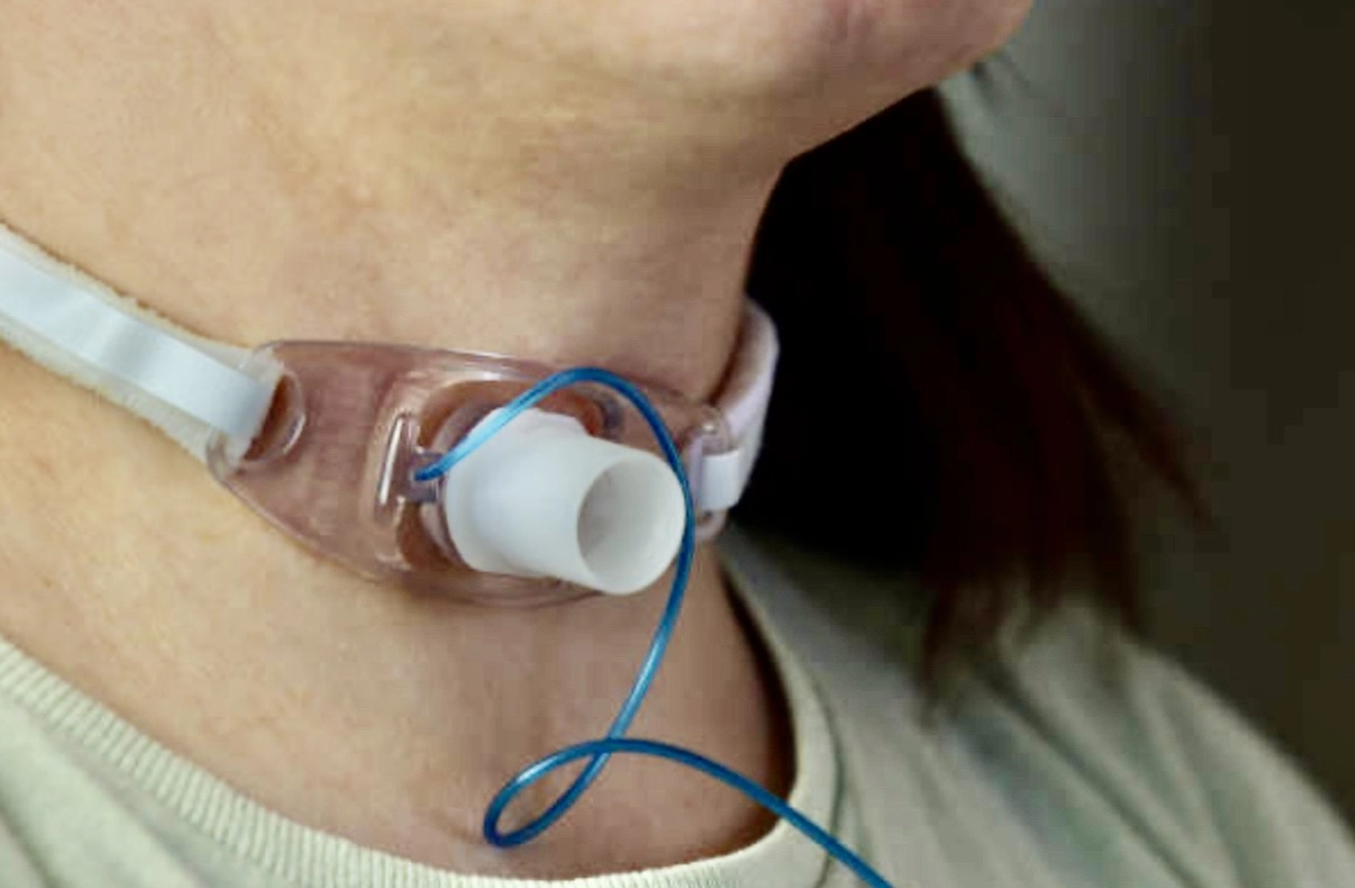 Dana Depenthal - Praxis für Logopädie - Halsschmerzen