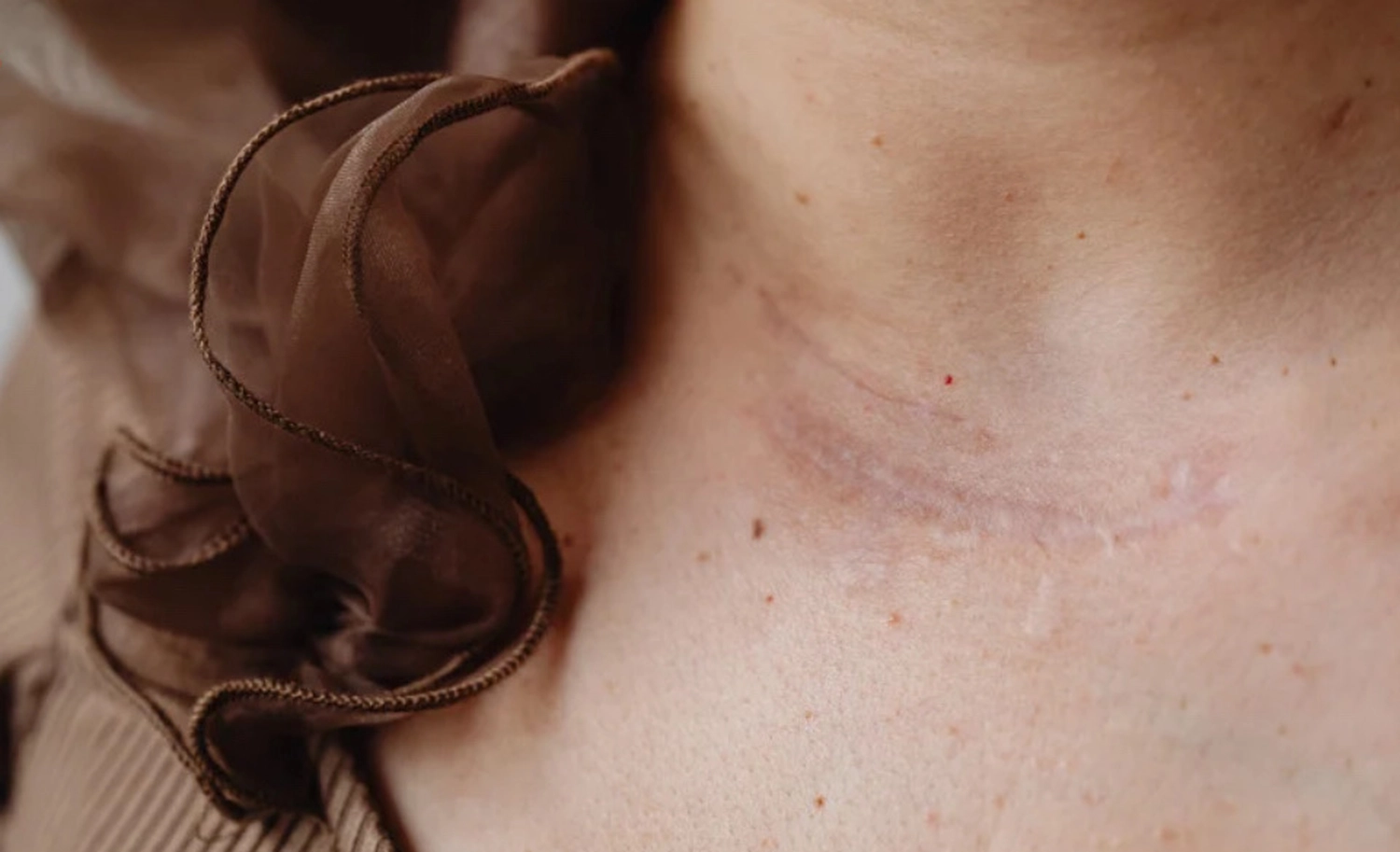 Dana Depenthal - Praxis für Logopädie - Damenhals